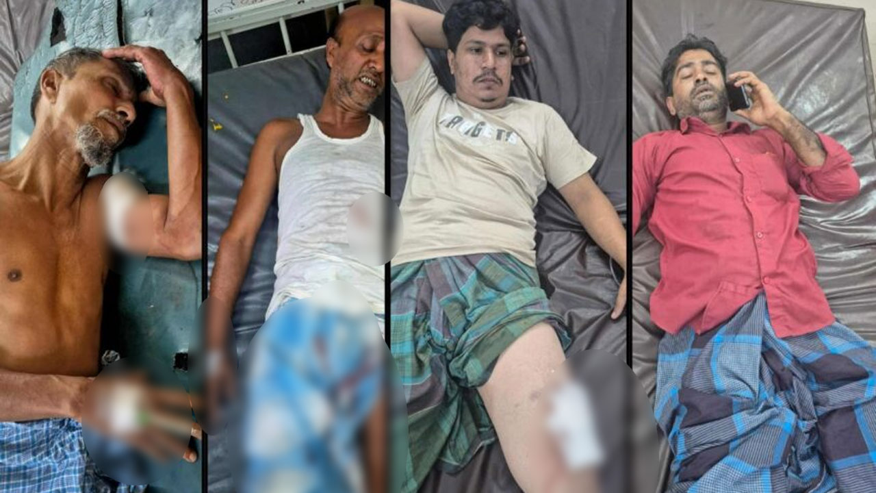 রাউজানে সভা শেষে ফেরার পথে গুলিতে বিএনপির ৫ নেতাকর্মি আহত