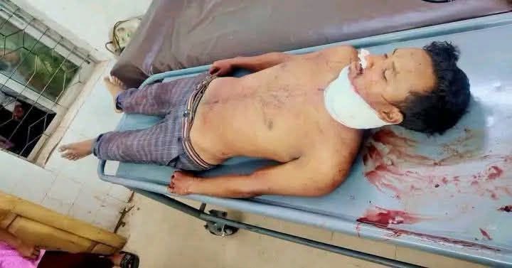গাইবান্ধার সাঘাটায় যুবদল নেতার হামলায় শিবির নেতা নিহত