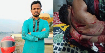 দিনাজপুরে শিবিরের সাবেক সভাপতিকে কুপিয়ে জখম করেছে সন্ত্রাসীরা